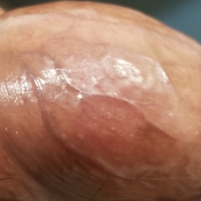 Penis