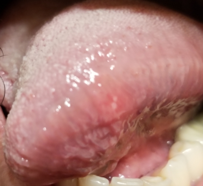 Tongue